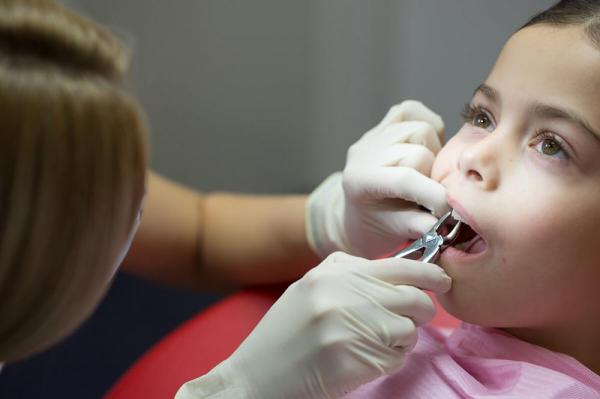 Процесс и последствия: Удаление молочных зубов