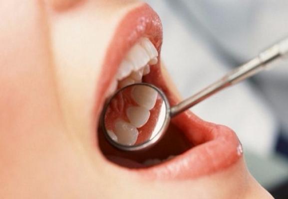 Лечение зубов в Мытищи