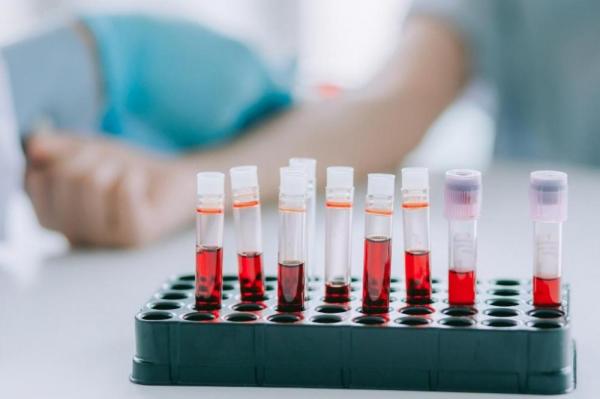 Показания и проведение биохимического анализа крови