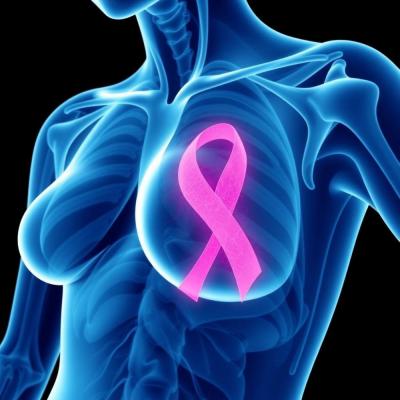 Рак молочной железы 1 стадии: от первых симптомов до лечения